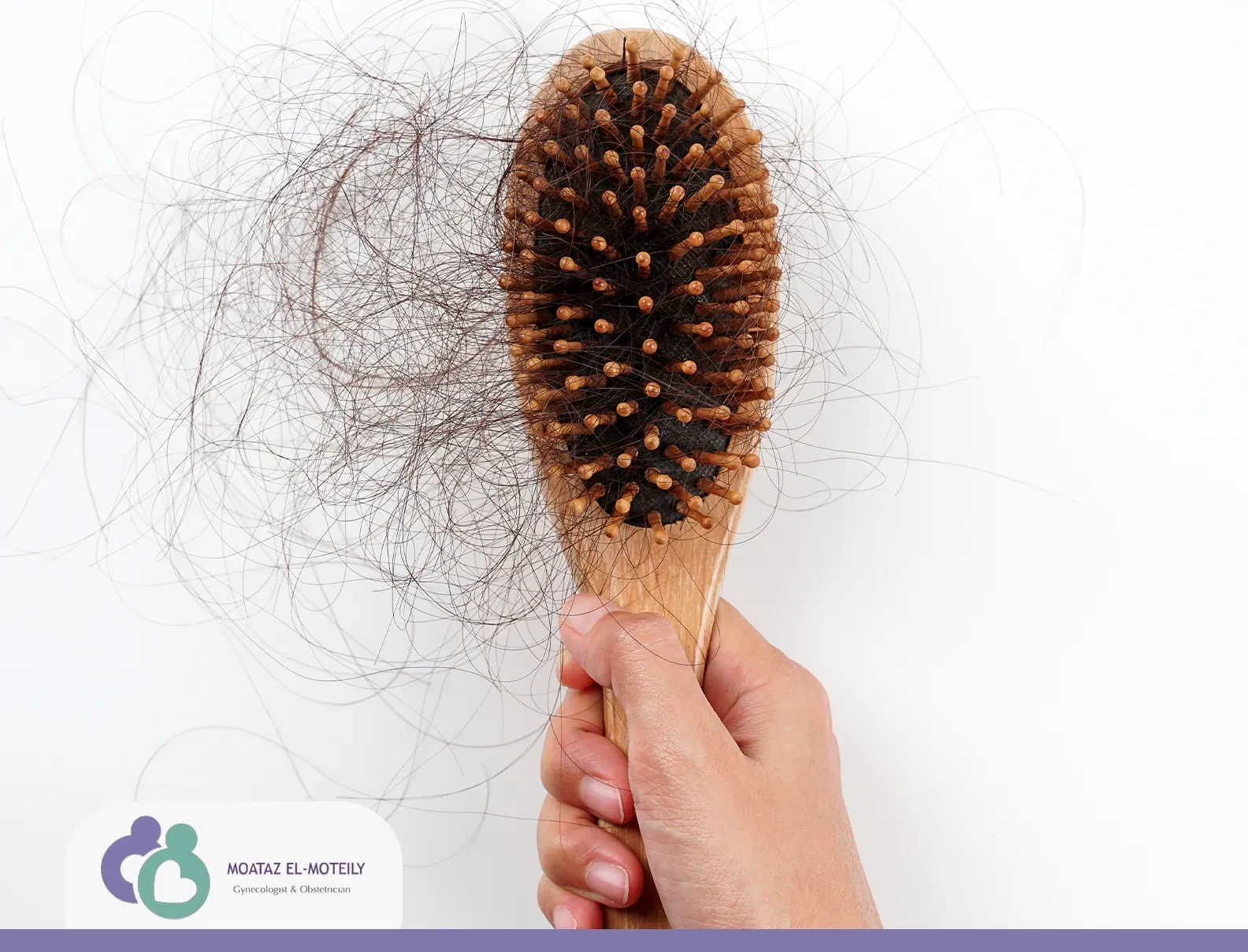 هل الورم الليفي يسبب تساقط الشعر