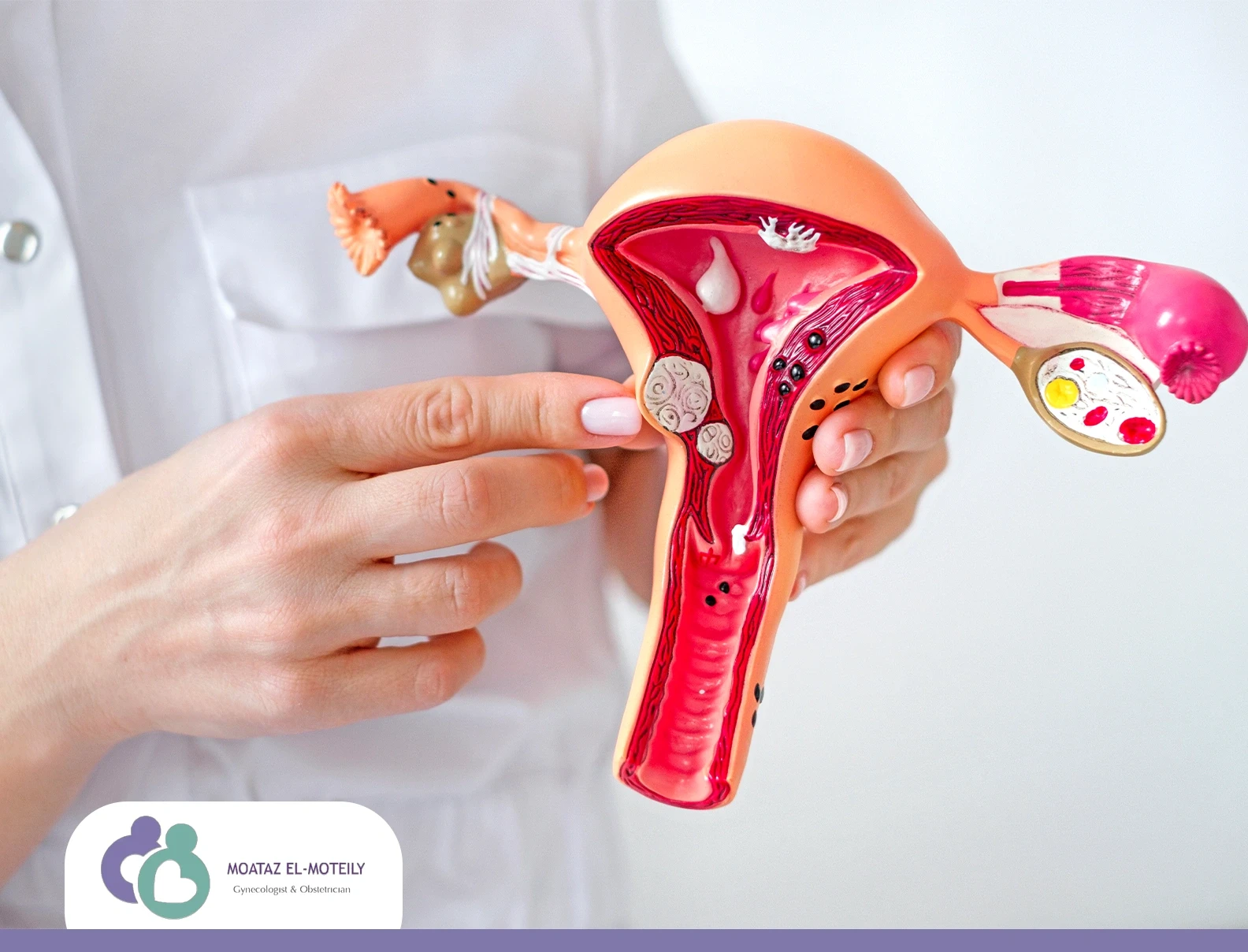 هل تظهر التصاقات الرحم بالسونار