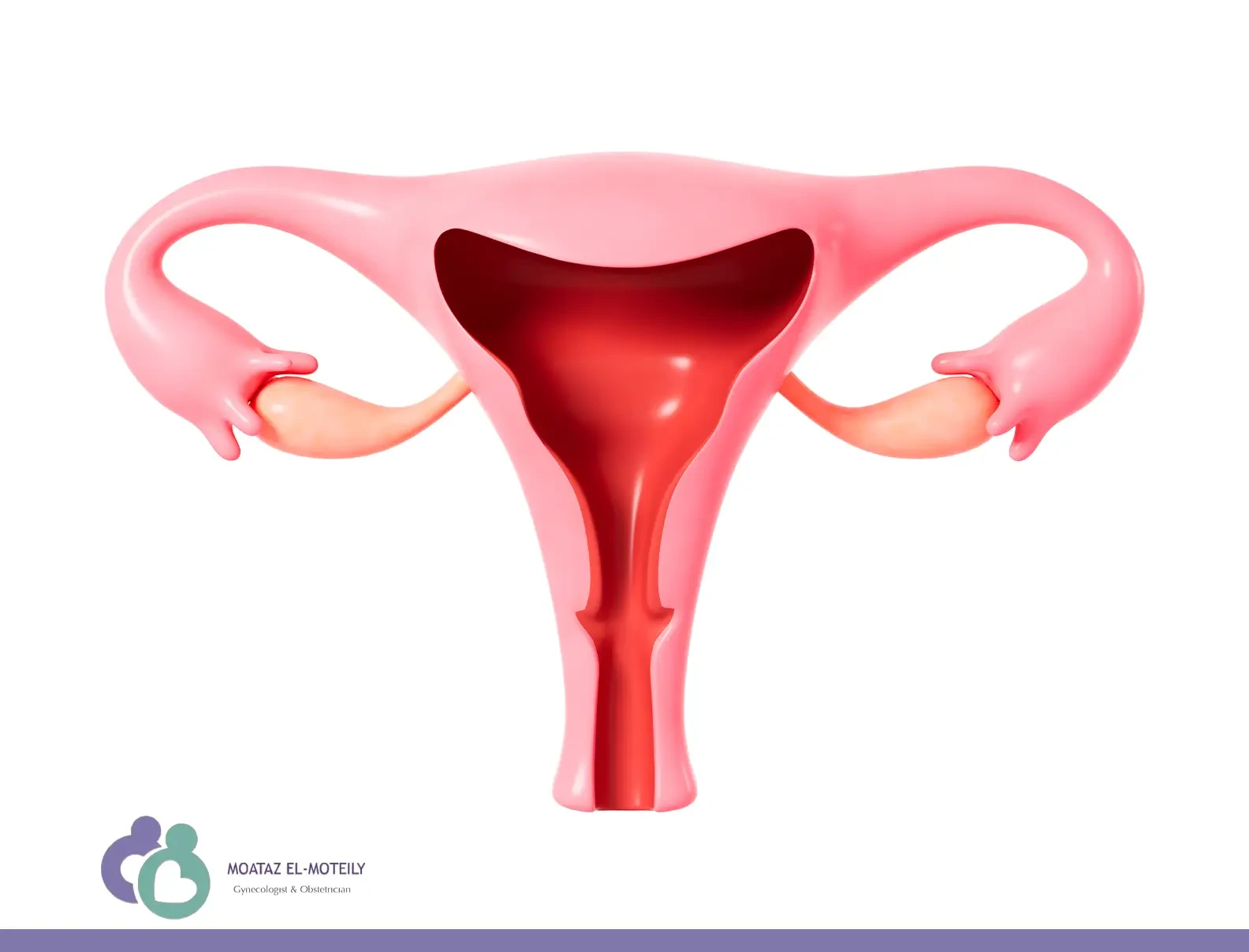 كيس على المبيض حجمه 10 سم