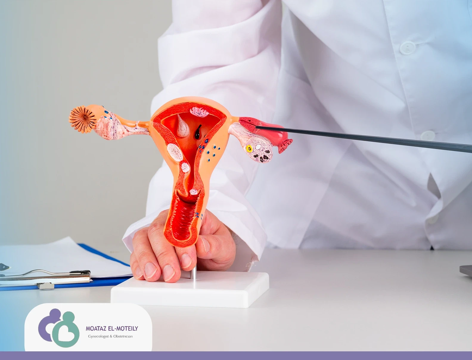 تكلفة المنظار الرحمي