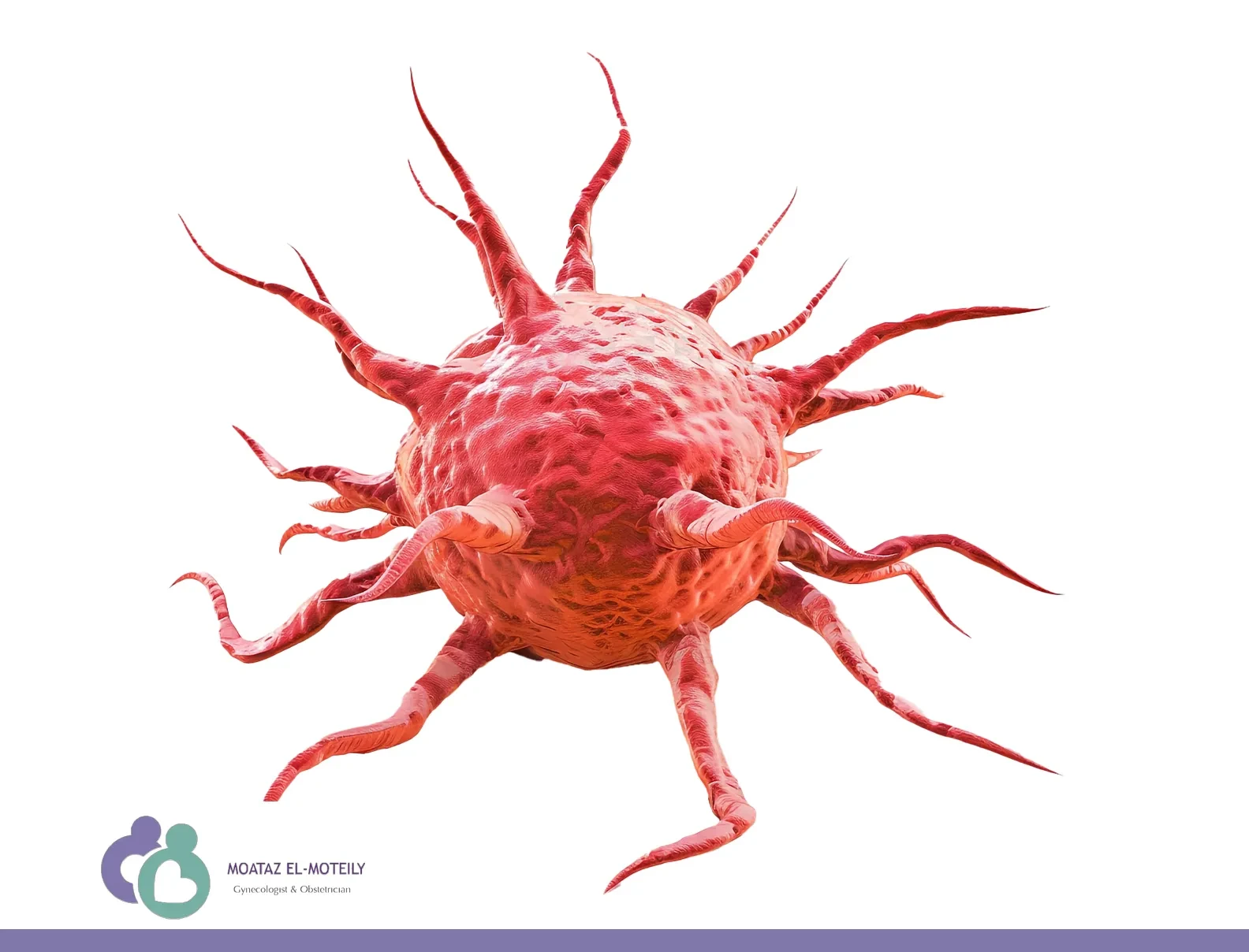 شكل الورم الليفي في الرحم