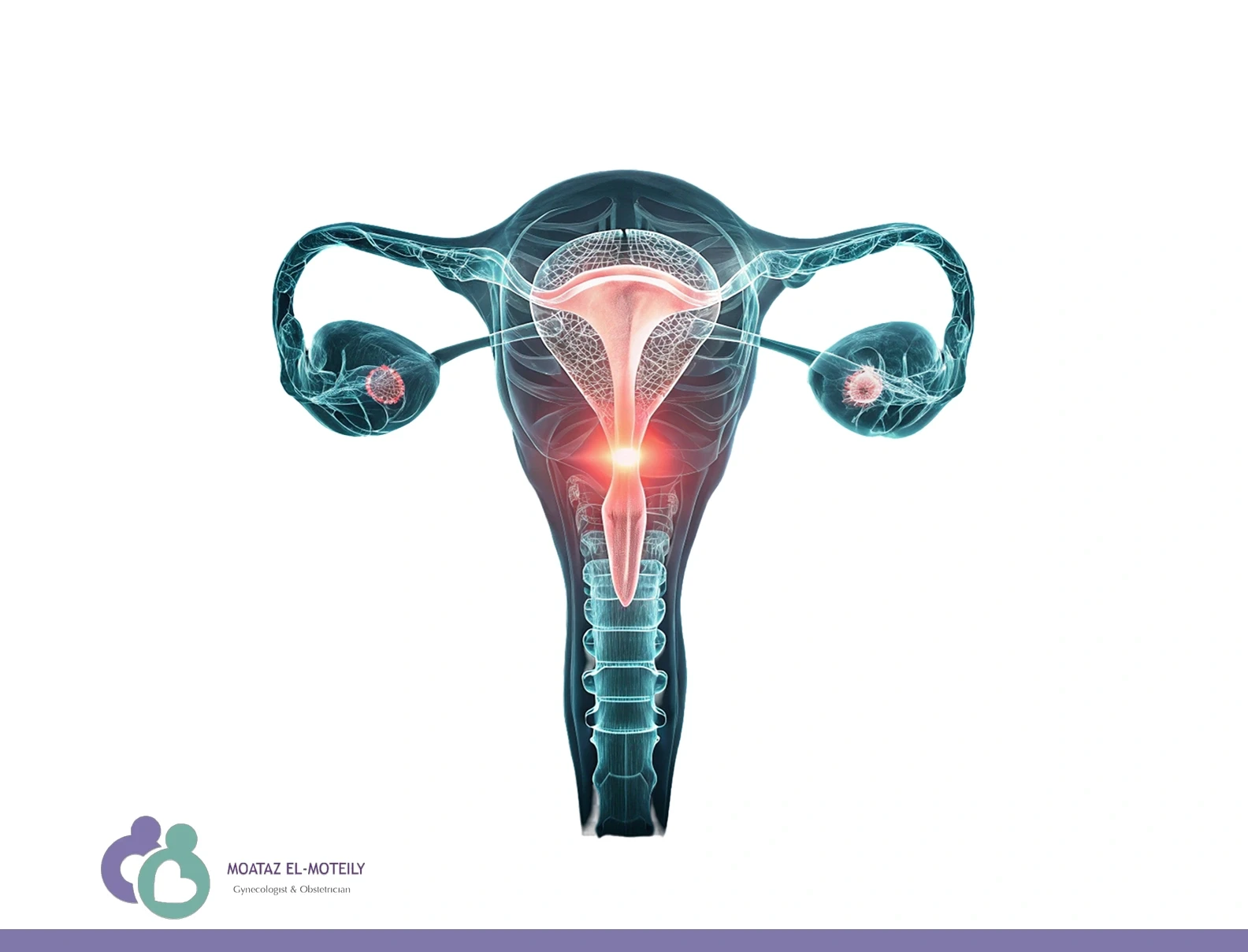 علاج التصاقات الرحم بدون جراحة