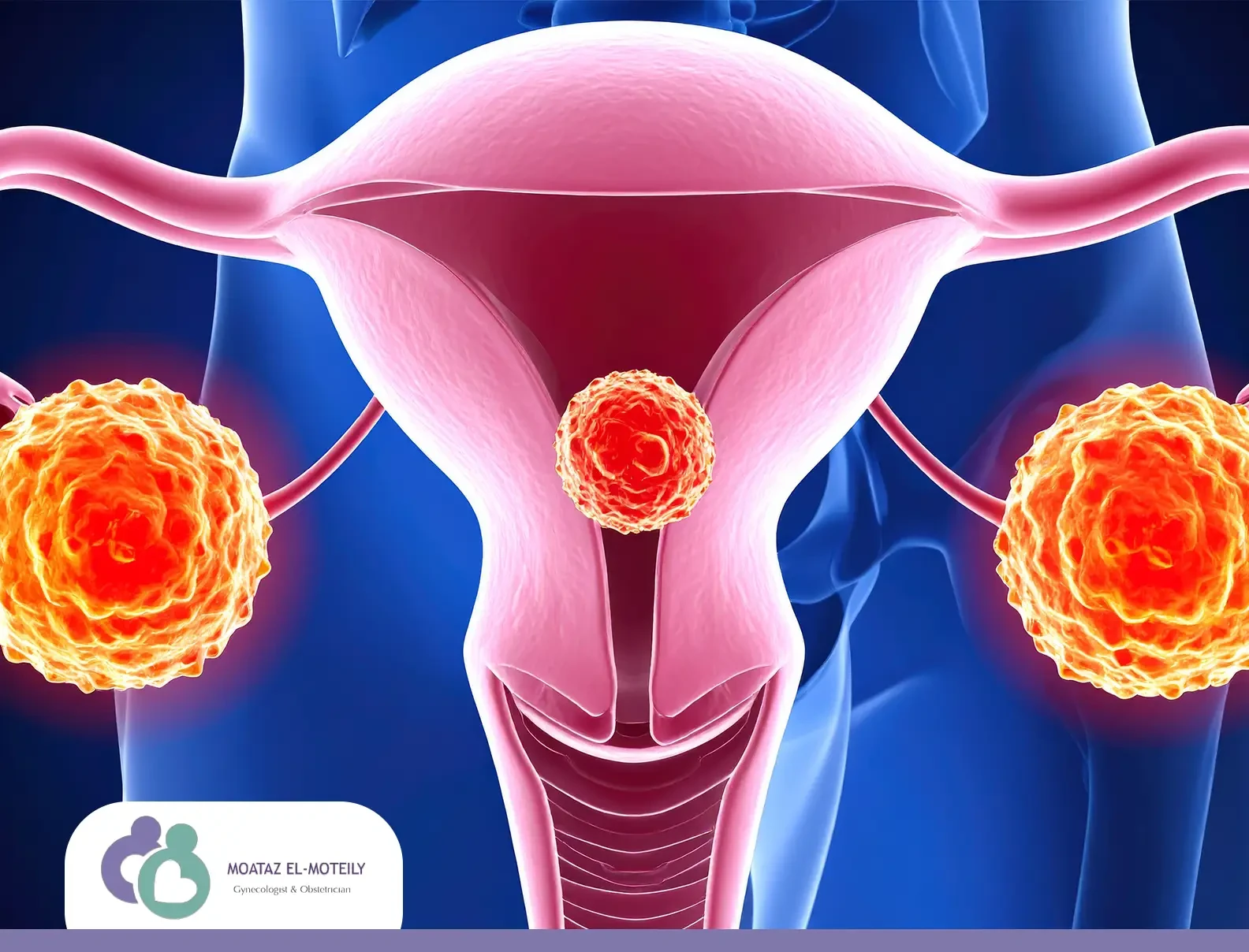 هل انفجار كيس المبيض خطير؟