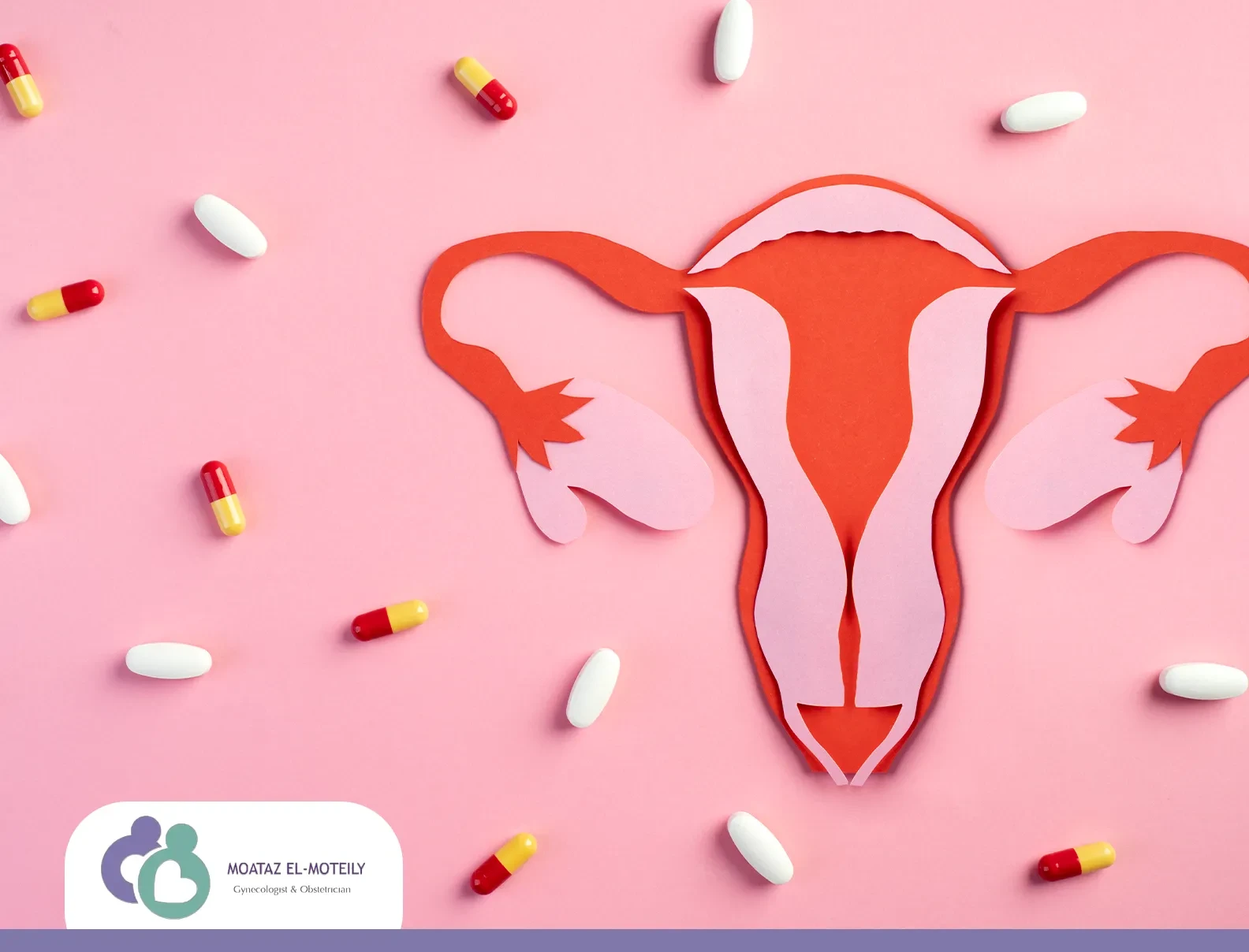 علاج تكيس المبايض للمتزوجة