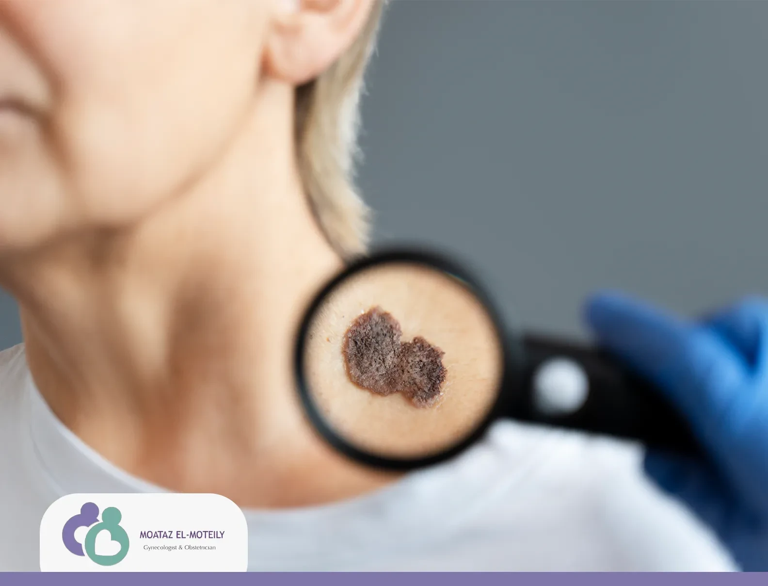 ما هو حجم الورم الليفي الطبيعي