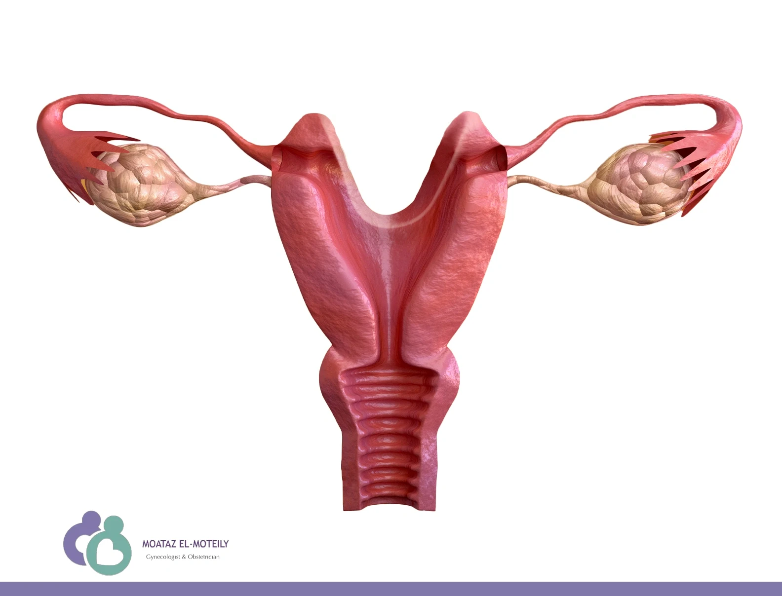 متى يجب إزالة كيس المبيض