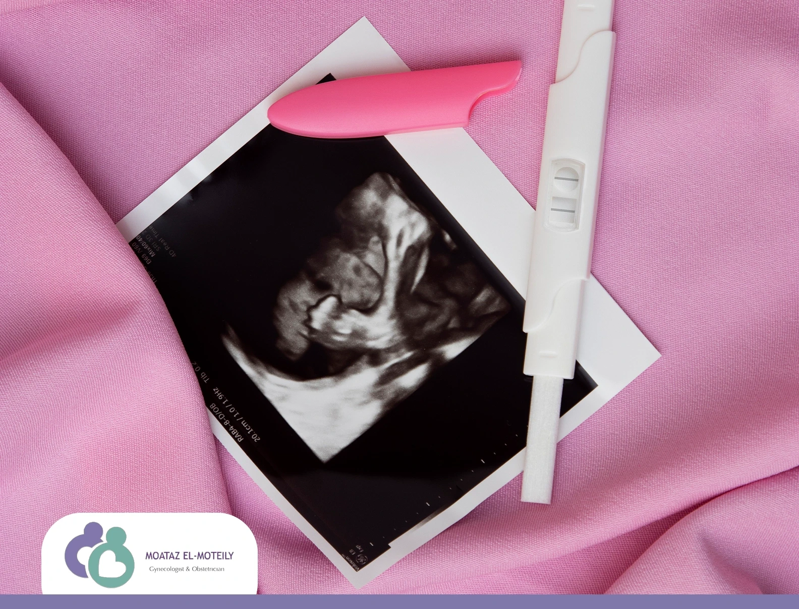 اعراض ضعف الخصوبة عند المراة