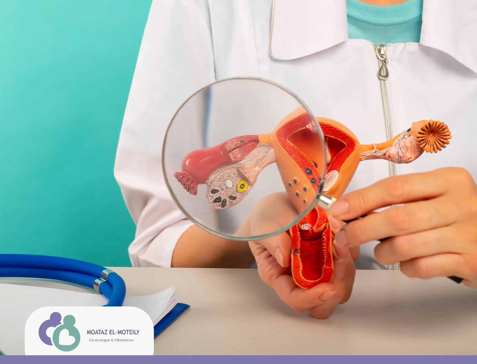 تكيسات المبايض وعلاجها