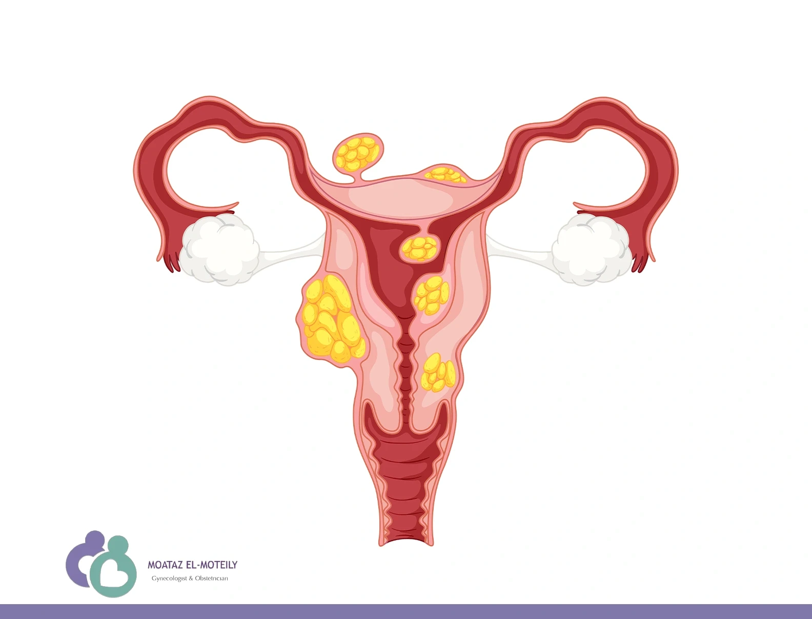 ما هو المنظار الرحمي