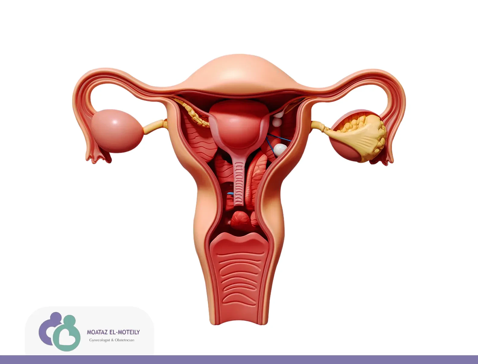 ربط عنق الرحم